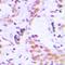 Elongin A3 antibody, orb215391, Biorbyt, Immunohistochemistry paraffin image 