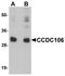 Coiled-coil domain-containing protein 106 antibody, A15044-1, Boster Biological Technology, Western Blot image 