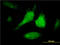 Signal Transducer And Activator Of Transcription 1 antibody, LS-C198276, Lifespan Biosciences, Immunofluorescence image 