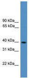 Paired Box 2 antibody, TA329224, Origene, Western Blot image 