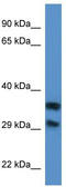 Methylthioribose-1-phosphate isomerase antibody, TA342960, Origene, Western Blot image 