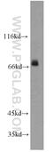 Glucose 1,6-bisphosphate synthase antibody, 13942-1-AP, Proteintech Group, Western Blot image 