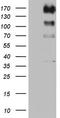 ALK Receptor Tyrosine Kinase antibody, TA801057S, Origene, Western Blot image 