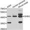 Sex Hormone Binding Globulin antibody, LS-C349154, Lifespan Biosciences, Western Blot image 