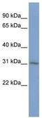 CKLF Like MARVEL Transmembrane Domain Containing 2 antibody, TA329336, Origene, Western Blot image 