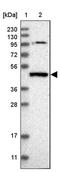 Peptidoglycan Recognition Protein 3 antibody, PA5-56450, Invitrogen Antibodies, Western Blot image 