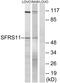 Serine And Arginine Rich Splicing Factor 11 antibody, GTX87310, GeneTex, Western Blot image 