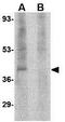 Regulating Synaptic Membrane Exocytosis 3 antibody, GTX31334, GeneTex, Western Blot image 