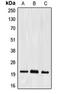 Ephrin A2 antibody, orb213873, Biorbyt, Western Blot image 