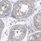 Monoglyceride Lipase antibody, PA5-52891, Invitrogen Antibodies, Immunohistochemistry frozen image 