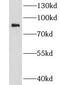 Chondroitin Polymerizing Factor antibody, FNab01670, FineTest, Western Blot image 