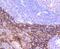 Keratin 16 antibody, NBP2-67559, Novus Biologicals, Immunohistochemistry paraffin image 