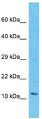 L Antigen Family Member 3 antibody, TA337406, Origene, Western Blot image 