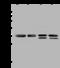B36-VDAC antibody, 202626-T42, Sino Biological, Western Blot image 