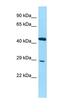 CDV3 Homolog antibody, orb326593, Biorbyt, Western Blot image 