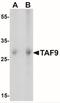 Adenylate Kinase 6 antibody, NBP2-41266, Novus Biologicals, Western Blot image 