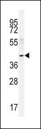 MTS antibody, LS-C164833, Lifespan Biosciences, Western Blot image 