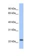 NADH-ubiquinone oxidoreductase chain 6 antibody, orb325568, Biorbyt, Western Blot image 