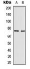 p65 antibody, LS-C358296, Lifespan Biosciences, Western Blot image 