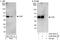 CXADR Ig-Like Cell Adhesion Molecule antibody, A302-848A, Bethyl Labs, Western Blot image 