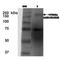 ATP Binding Cassette Subfamily C Member 9 antibody, MA5-27636, Invitrogen Antibodies, Western Blot image 