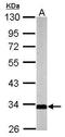 Mitochondrial glutamate carrier 1 antibody, PA5-30822, Invitrogen Antibodies, Western Blot image 