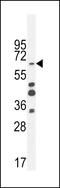 Zinc Finger Protein 98 antibody, LS-C160964, Lifespan Biosciences, Western Blot image 