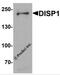 Protein dispatched homolog 1 antibody, 6629, ProSci, Western Blot image 