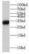 Lactate Dehydrogenase A Like 6A antibody, FNab04736, FineTest, Western Blot image 