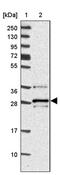 Vesicle Transport Through Interaction With T-SNAREs 1B antibody, PA5-60618, Invitrogen Antibodies, Western Blot image 