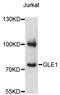 GLE1 RNA Export Mediator antibody, LS-C748268, Lifespan Biosciences, Western Blot image 