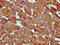 Spindle And Kinetochore Associated Complex Subunit 2 antibody, LS-C681340, Lifespan Biosciences, Immunohistochemistry paraffin image 