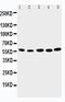 Abl Interactor 2 antibody, GTX12303, GeneTex, Western Blot image 