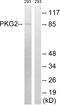 cGMP-dependent protein kinase 2 antibody, LS-C199467, Lifespan Biosciences, Western Blot image 