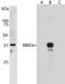 Aurora Kinase B antibody, NBP2-50054, Novus Biologicals, Western Blot image 