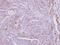 Zinc Finger DHHC-Type Containing 11 antibody, PA5-28503, Invitrogen Antibodies, Immunohistochemistry paraffin image 