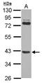SET and MYND domain-containing protein 3 antibody, LS-C155678, Lifespan Biosciences, Western Blot image 