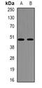 NADH:Ubiquinone Oxidoreductase Core Subunit V1 antibody, orb381909, Biorbyt, Western Blot image 