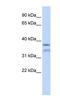 HYLS1 Centriolar And Ciliogenesis Associated antibody, NBP1-56899, Novus Biologicals, Western Blot image 
