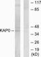 Protein Kinase CAMP-Dependent Type I Regulatory Subunit Alpha antibody, TA312524, Origene, Western Blot image 