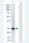 Ras-related protein Rab-6B antibody, H00051560-M02-100ug, Novus Biologicals, Western Blot image 