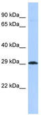 Acyl-CoA Synthetase Family Member 3 antibody, TA338311, Origene, Western Blot image 