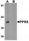 Proline Rich 5 antibody, TA319960, Origene, Western Blot image 