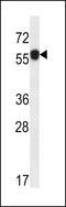 Acidic Residue Methyltransferase 1 antibody, 58-383, ProSci, Western Blot image 