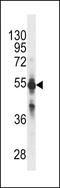 Cytochrome P450 Family 2 Subfamily C Member 9 antibody, LS-C157676, Lifespan Biosciences, Western Blot image 