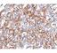 Epithelial Cell Adhesion Molecule antibody, V2694IHC-7ML, NSJ Bioreagents, Immunohistochemistry paraffin image 