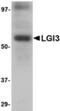 Leucine-rich repeat LGI family member 3 antibody, TA306538, Origene, Western Blot image 