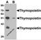 Thymopoietin antibody, 6605, ProSci, Western Blot image 