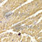 Peroxisomal targeting signal 1 receptor antibody, A5780, ABclonal Technology, Immunohistochemistry paraffin image 