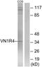 Vomeronasal 1 Receptor 4 antibody, GTX86970, GeneTex, Western Blot image 